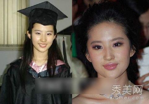 明星爆料整容视频大全下载,视频大全下载解析 第2张 明星爆料整容视频大全下载,视频大全下载解析 第2张